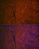 FABP3 Antibody in Immunohistochemistry (Paraffin) (IHC (P))