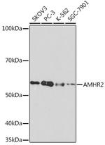 AMHR2 Antibody in Western Blot (WB)