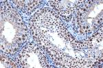 Bub3 Antibody in Immunohistochemistry (Paraffin) (IHC (P))