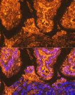 FABP2 Antibody in Immunohistochemistry (Paraffin) (IHC (P))