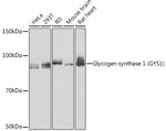 GYS1 Antibody in Western Blot (WB)