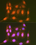 LTA4H Antibody in Immunocytochemistry (ICC/IF)