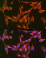 LTA4H Antibody in Immunocytochemistry (ICC/IF)