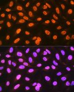 hnRNP C Antibody in Immunocytochemistry (ICC/IF)