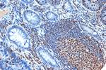 FEN1 Antibody in Immunohistochemistry (Paraffin) (IHC (P))