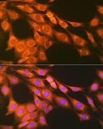 PTGER2 Antibody in Immunocytochemistry (ICC/IF)