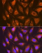 PTGER2 Antibody in Immunocytochemistry (ICC/IF)