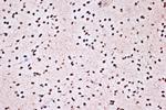 KHSRP Antibody in Immunohistochemistry (Paraffin) (IHC (P))