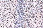 KHSRP Antibody in Immunohistochemistry (Paraffin) (IHC (P))