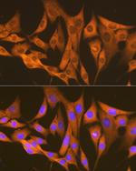 ASS1 Antibody in Immunocytochemistry (ICC/IF)