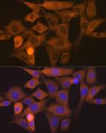 NCK1 Antibody in Immunocytochemistry (ICC/IF)