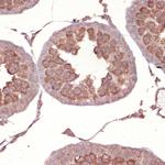 NCK1 Antibody in Immunohistochemistry (Paraffin) (IHC (P))