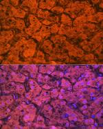 Hemopexin Antibody in Immunohistochemistry (Paraffin) (IHC (P))