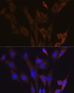 ABCE1 Antibody in Immunocytochemistry (ICC/IF)