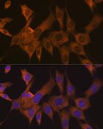 eIF3b Antibody in Immunocytochemistry (ICC/IF)