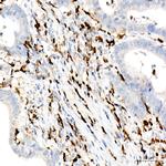 CD74 Antibody in Immunohistochemistry (Paraffin) (IHC (P))