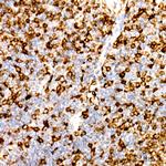 CD74 Antibody in Immunohistochemistry (Paraffin) (IHC (P))