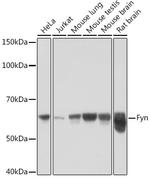 Fyn Antibody in Western Blot (WB)