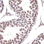 HMGB2 Antibody in Immunohistochemistry (Paraffin) (IHC (P))