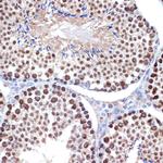 HMGB2 Antibody in Immunohistochemistry (Paraffin) (IHC (P))