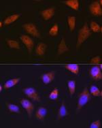 PSMA2 Antibody in Immunocytochemistry (ICC/IF)