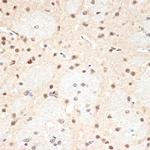 PSMA2 Antibody in Immunohistochemistry (Paraffin) (IHC (P))