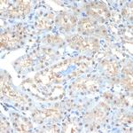 PSMA2 Antibody in Immunohistochemistry (Paraffin) (IHC (P))