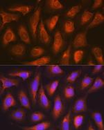 SOCS2 Antibody in Immunocytochemistry (ICC/IF)