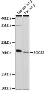 SOCS2 Antibody in Western Blot (WB)