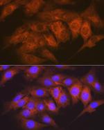 CaMKII delta Antibody in Immunocytochemistry (ICC/IF)