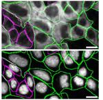 CaMKII delta Antibody in Immunocytochemistry (ICC/IF)