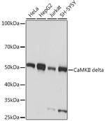 CaMKII delta Antibody in Western Blot (WB)