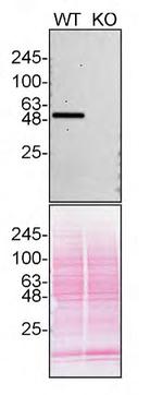 CaMKII delta Antibody in Western Blot (WB)