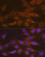 IMPDH2 Antibody in Immunocytochemistry (ICC/IF)