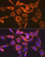 IMPDH2 Antibody in Immunocytochemistry (ICC/IF)