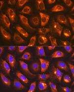 IMPDH2 Antibody in Immunocytochemistry (ICC/IF)