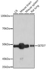 SETD7 Antibody in Western Blot (WB)