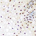 UBE1 Antibody in Immunohistochemistry (Paraffin) (IHC (P))