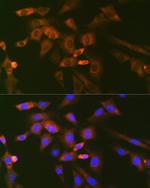 UBC13 Antibody in Immunocytochemistry (ICC/IF)