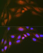 UBC13 Antibody in Immunocytochemistry (ICC/IF)