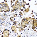 UBC13 Antibody in Immunohistochemistry (Paraffin) (IHC (P))