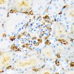 Hemoglobin alpha Antibody in Immunohistochemistry (Paraffin) (IHC (P))