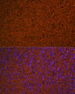 Hemoglobin alpha Antibody in Immunohistochemistry (Paraffin) (IHC (P))