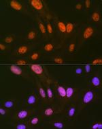 HIPK2 Antibody in Immunocytochemistry (ICC/IF)