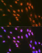 HnRNP Q Antibody in Immunocytochemistry (ICC/IF)