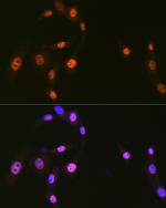 HnRNP Q Antibody in Immunocytochemistry (ICC/IF)