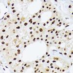 HnRNP Q Antibody in Immunohistochemistry (Paraffin) (IHC (P))