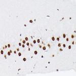 HnRNP Q Antibody in Immunohistochemistry (Paraffin) (IHC (P))