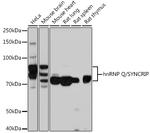 HnRNP Q Antibody in Western Blot (WB)