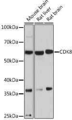 CDK8 Antibody in Western Blot (WB)